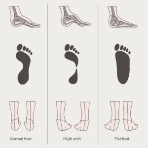 RUNNERS GUIDE TO THE RIGHT FOOTWEAR 1 The+wet+foot+test